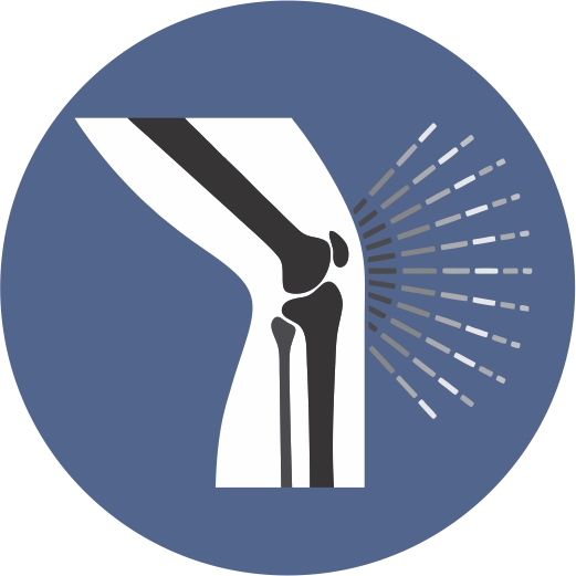 Logo del servicio Cirugía De Rodilla